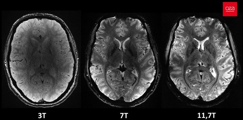 The Best MRI in the&nbsp;World